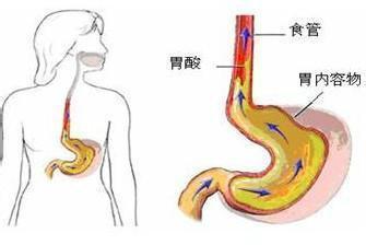 如何通过食物调整身体PH值平衡健康状态