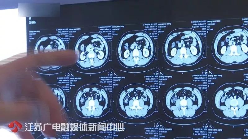 20岁小伙拉肚子数日后确诊癌症的惊人历程