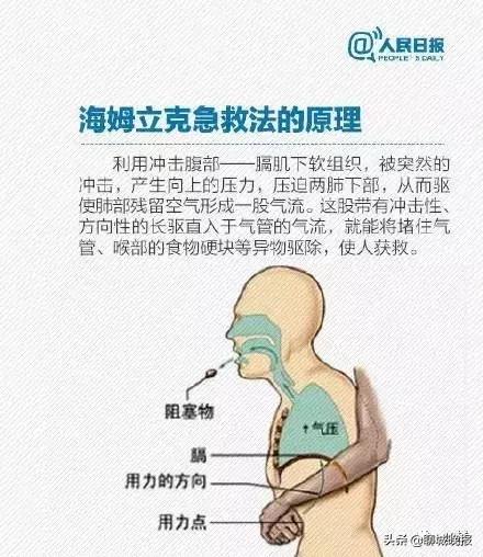 孩子窒息急救步骤与方法指南